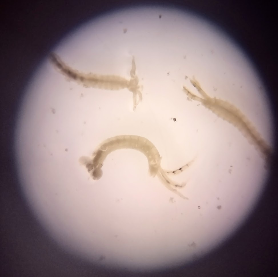 View through a microscope of three grayish worms with tentacle-like appendages.